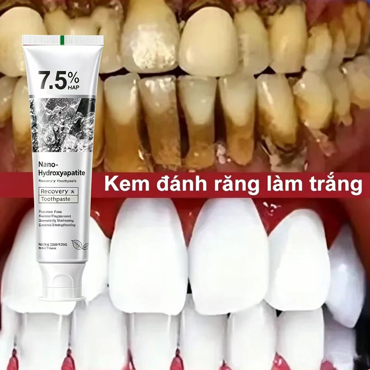 Teeth Whitening Cream - Pasta de Dente Clareadora com 7,5%
