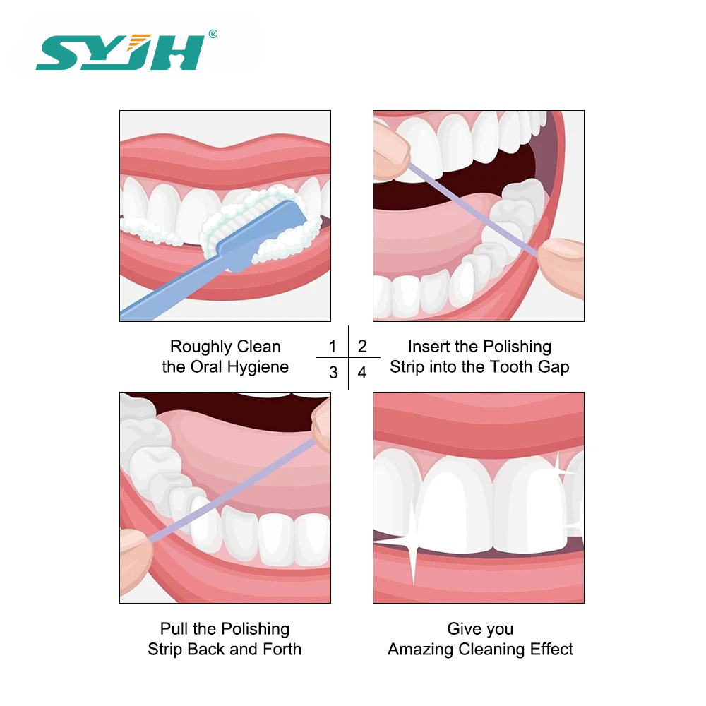 Kit de Polimento Dental em Rol - Teeth Whitening Kit avaliação e preço