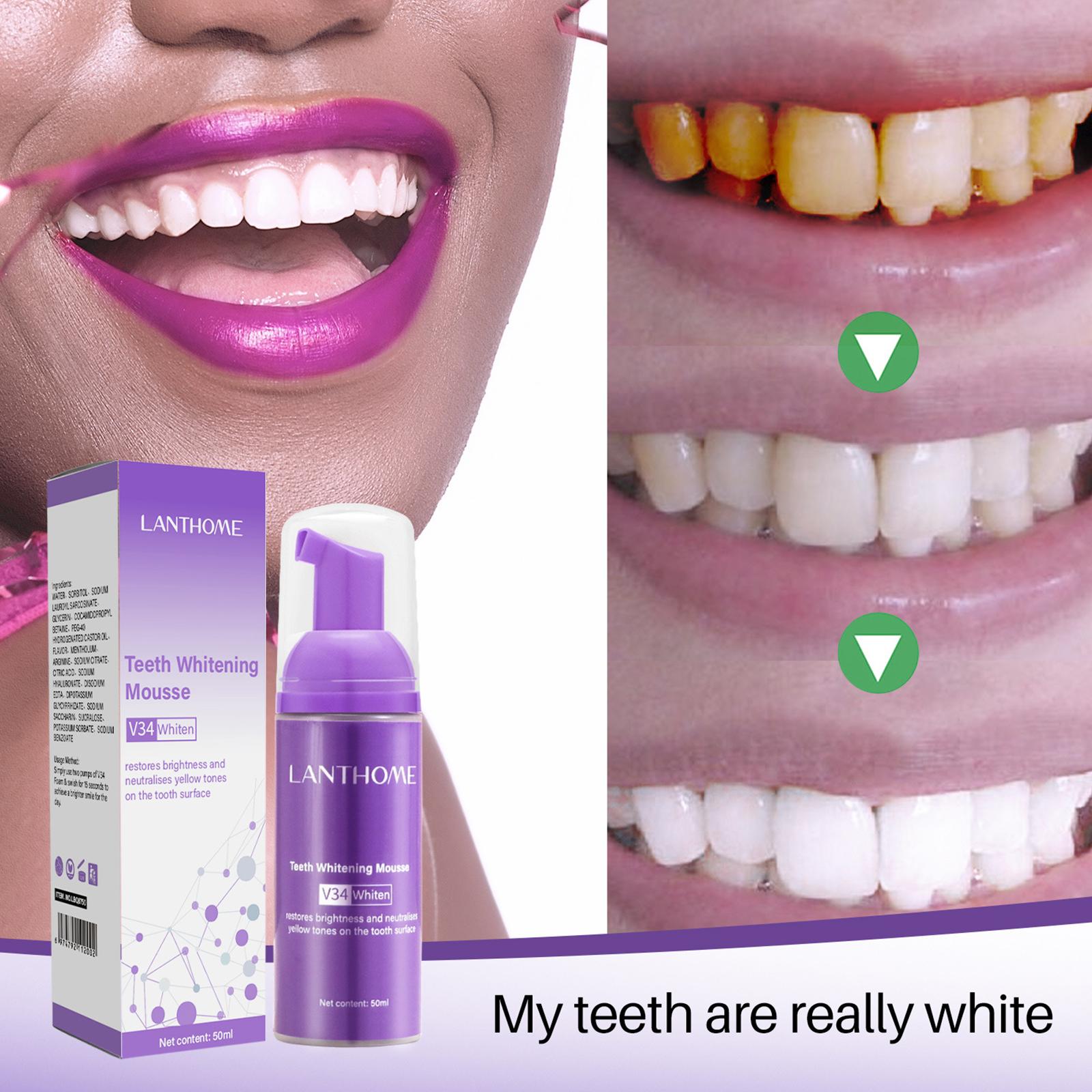 V34 mousse limpeza dos dentes  - Teeth Whitening Cream avaliação e preço