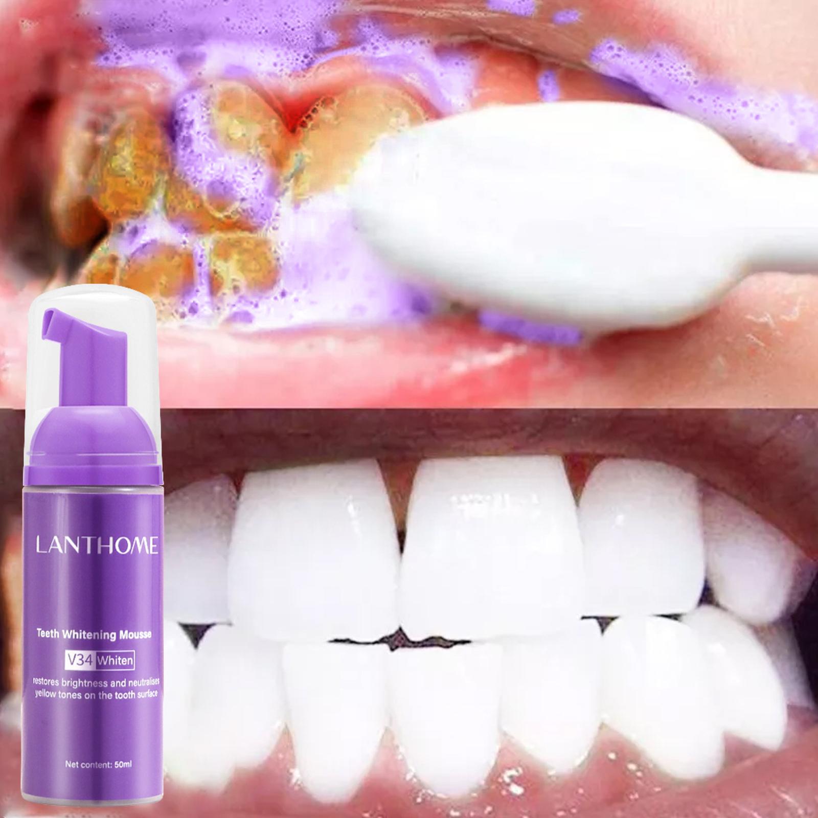 V34 mousse limpeza dos dentes  - Teeth Whitening Cream avaliação e preço