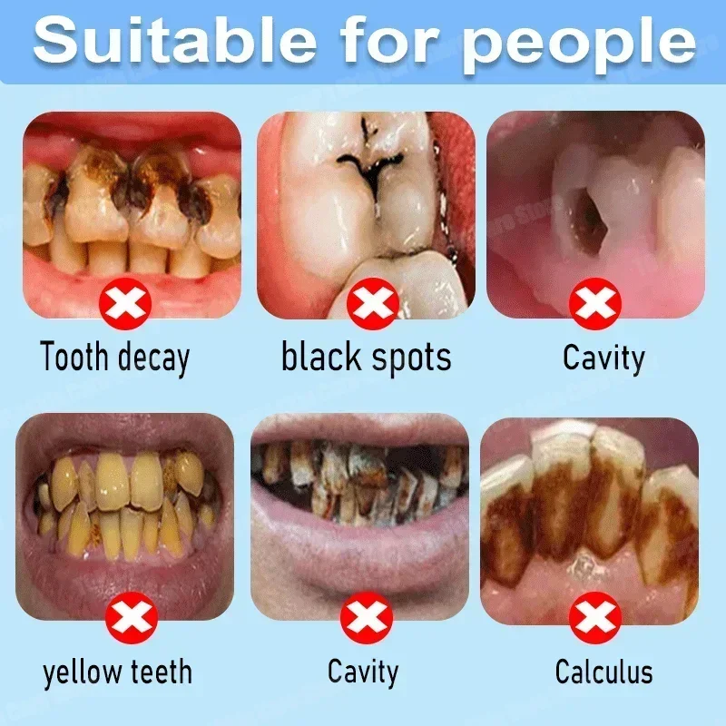 Pasta de Dente Anticáries: Rep - Teeth Whitening Cream avaliação e preço