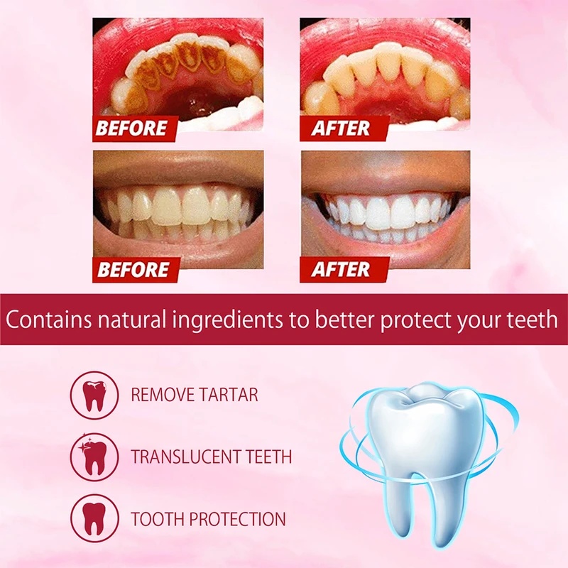 Pasta de dentes branqueadora c - Teeth Whitening Enzymes avaliação e preço
